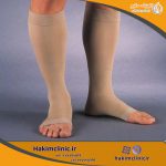جوراب واریس چیست: موارد کاربرد، انواع و خرید