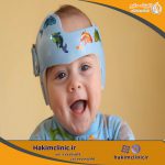 ارتز جمجمه برای نوزادان