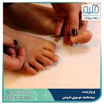 پروتز انگشت پا