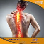 اسکولیوز چیست و درمان آن