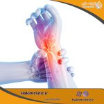 دلایل، علائم و درمان سندرم تونل کارپ