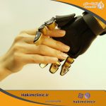 5 مورد اساسی که همه باید درباره پروتز بدانند!