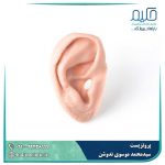 پروتز گوش