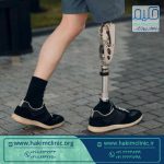 هر آنچه که باید پیش از انجام پروتز بدانید