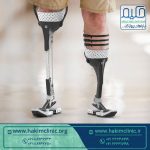 راهی ساده برای خرید اندام مصنوعی