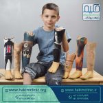 چگونه کودکان را آماده نصب پروتز زیر زانو کنیم؟