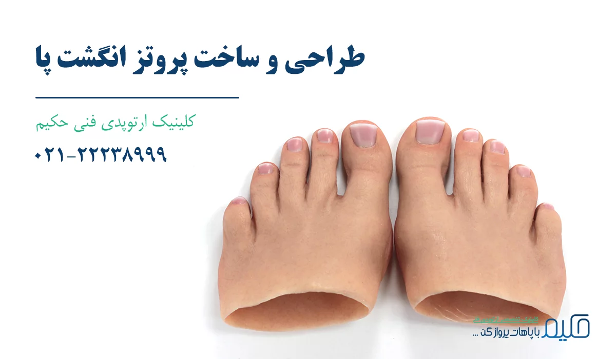 قیمت پروتز انگشت پا